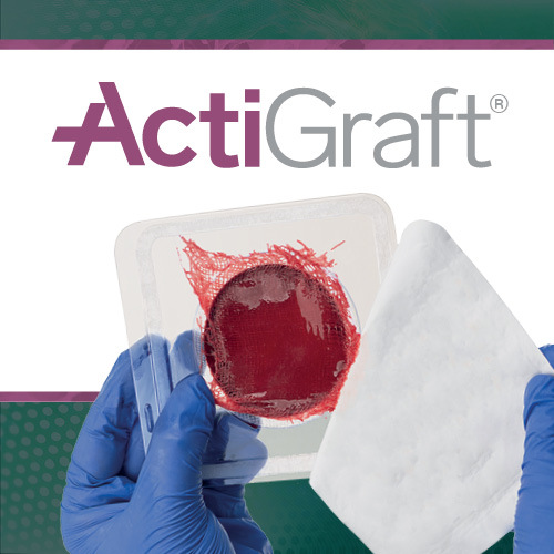 Legacy Medical Consultants Acquires Right to Sell RedDress ActiGraft Pro, Broadening Its Strong Wound Care Portfolio Beyond Allografts