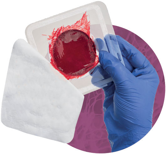 ActiGraft® Pro ActiGraft